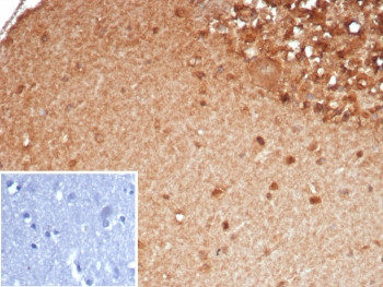 Anti-VMAT2 / SLC18A2, clone SLC18A2/7983