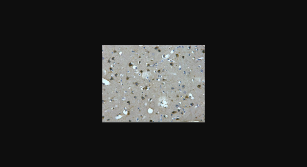 Anti-MAP2, monoclonal