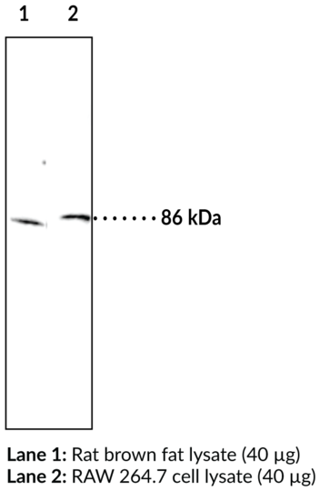 Anti-Hormone-Sensitive Lipase