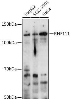Anti-RNF111