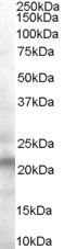 Anti-VPS25, Internal