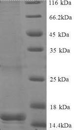 BEN domain-containing protein 3 (BEND3), partial, human, recombinant