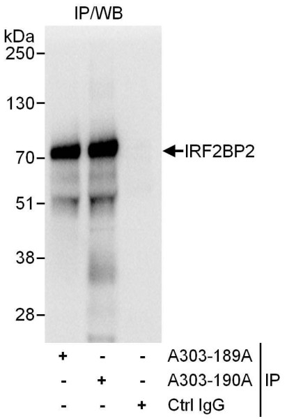 Anti-IRF2BP2