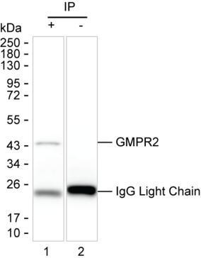 Anti-GMPR2