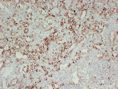 Anti-Thyroid Peroxidase (TPO)
