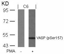 Anti-phospho-VASP (Ser157)