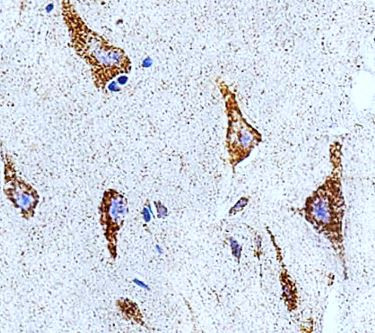 Anti-IDH3B