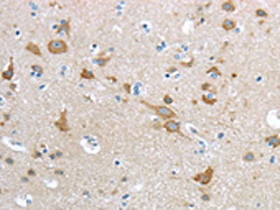 Anti-HCN4