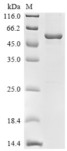 Cyclin-G-associated kinase (GAK), partial, Biotinylated, human, recombinant