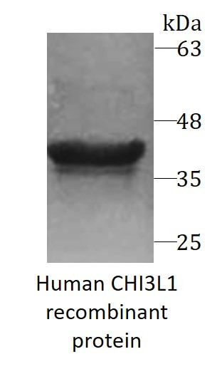Human CHI3L1 recombinant protein (His-tagged)