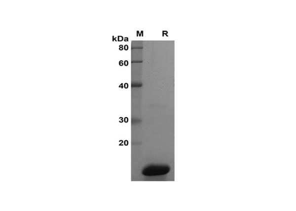 Recombinant SARS-CoV-2 M Protein