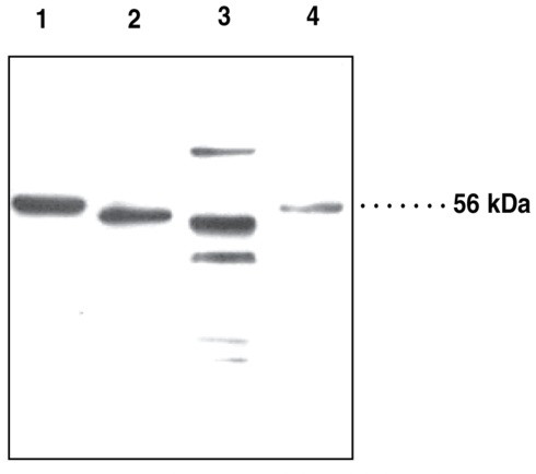 Anti-Adipose Triglyceride Lipase