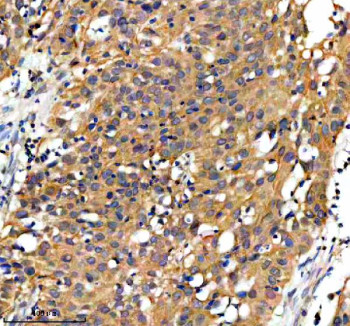 Anti-GPD1 / Glycerol-3-phosphate dehydrogenase 1
