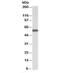 Anti-ALDH5A1