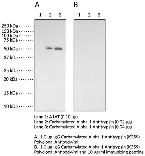 Anti-Carbamylated Alpha-1 Antitrypsin (K359)