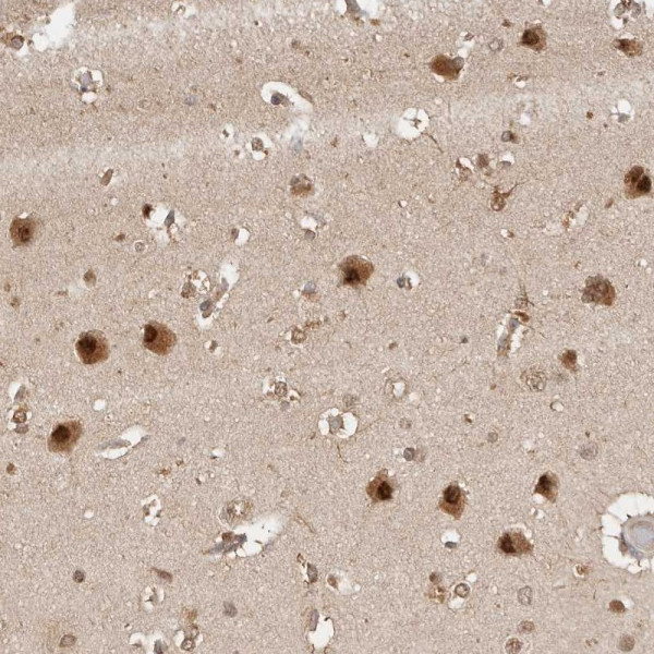 Anti-PSMA5