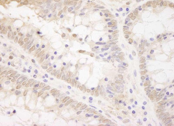 Anti-TCF12 (IHC)