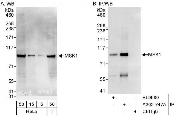 Anti-MSK1