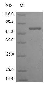 Ketohexokinase (KHK), human, recombinant