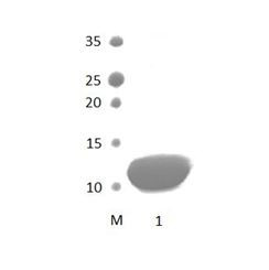 SCRIB_1 PDZ Domain