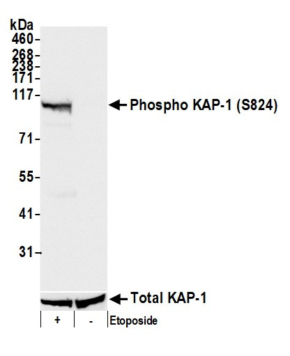 Anti-phospho-KAP-1 (Ser824)