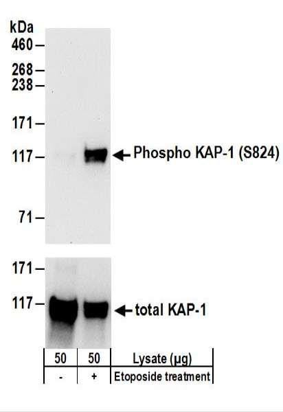 Anti-phospho-KAP-1 (Ser824)
