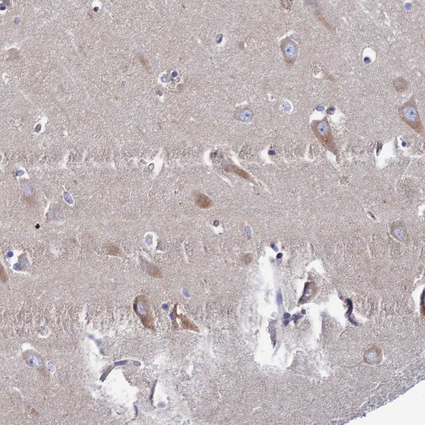 Anti-CLCN3