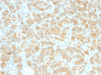 Anti-Glycoprotein 2 / GP2 / ZAP75, clone GP2/2569R