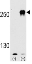 Anti-mTOR (FRAP1)