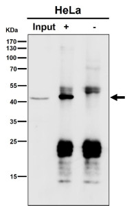 Anti-PSMC5 / 26S proteasome regulatory subunit 8, clone 29P84