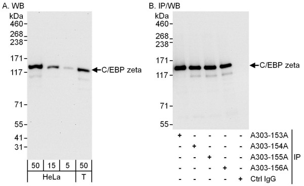 Anti-C/EBP zeta