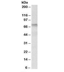 Anti-Transglutaminase 3