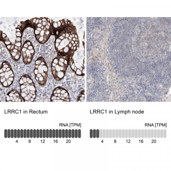 Anti-LRRC1