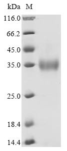Spike glycoprotein (S), partial, human betacoronavirus 2c EMC/2012, recombinant