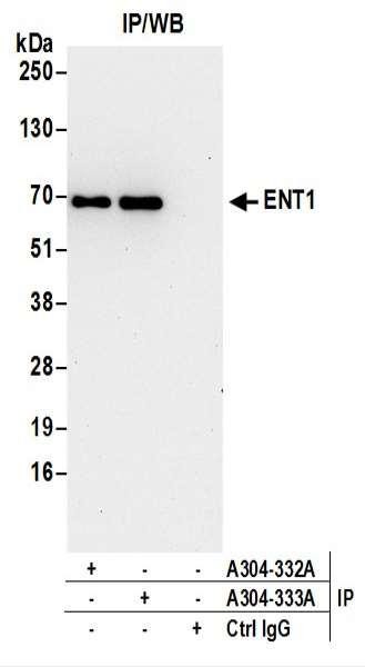 Anti-ENT1