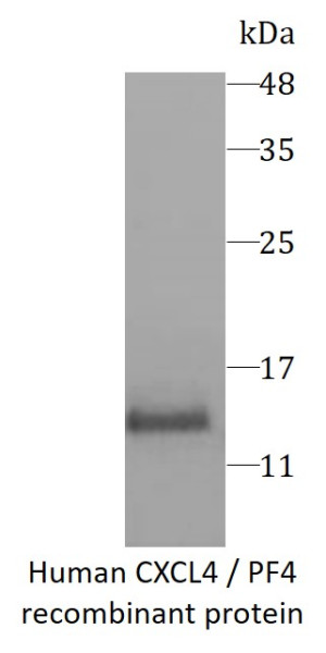 Human CXCL4 / PF4 recombinant protein (Active) (His-tagged)