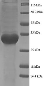 50S ribosomal protein L35 (rpmI), partial, Escherichia coli, recombinant
