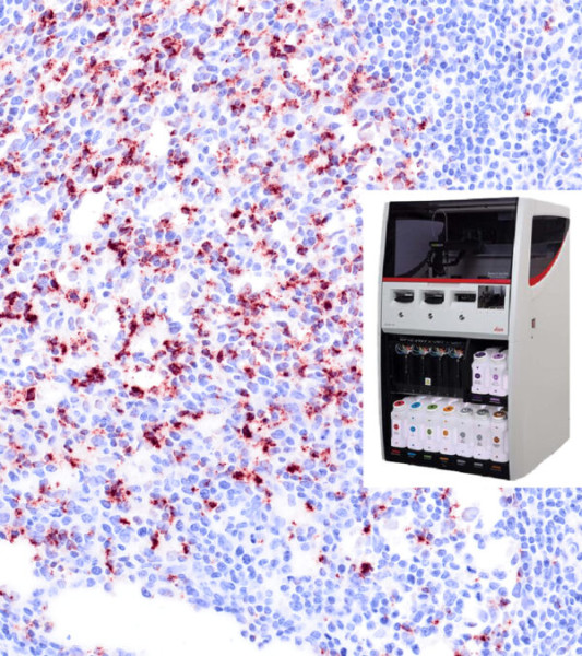 Naveni PD1 PD-L1 BOND RX HRP
