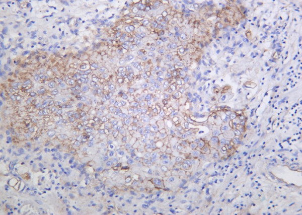 Anti-Recombinant Integrin alphaV, clone 9B6