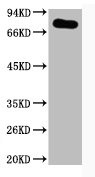 Anti-PTGS1