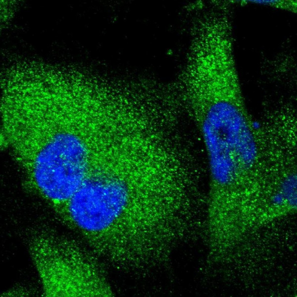 Anti-SERPINI1