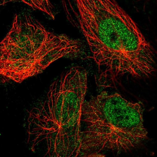 Anti-TRPM7