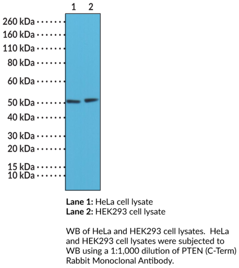 Anti-PTEN (C-Term) Rabbit Monoclonal Antibody (Clone RM265)