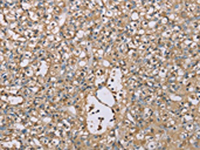 Anti-SCN1B