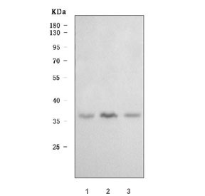 Anti-DNA-3-methyladenine glycosylase / MPG / AAG
