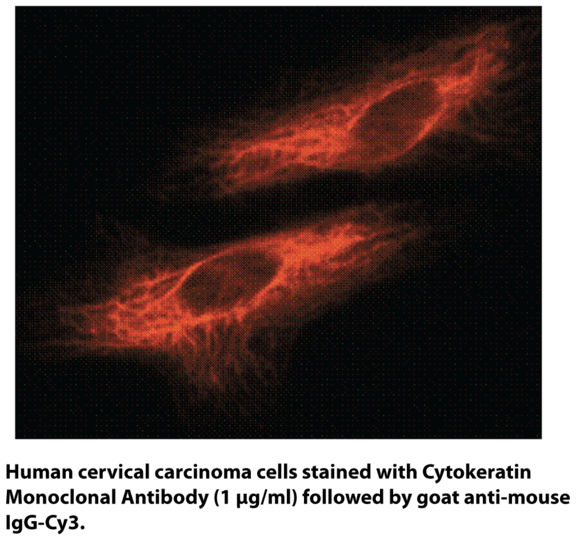Anti-Cytokeratin (Clone C-11)