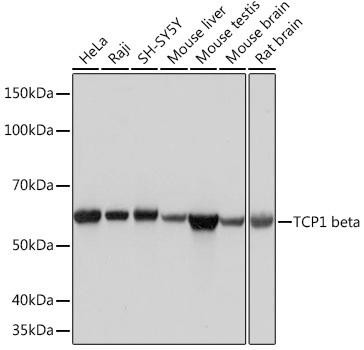 Anti-TCP1 beta/CCT2