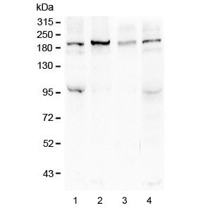 Anti-SI / Sucrase Isomaltase