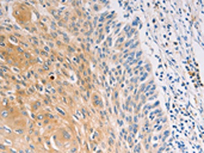 Anti-MUC5B