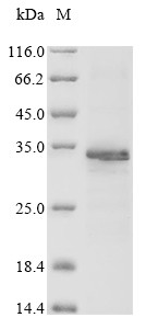 Allergen Ara h 1, clone P17,partial, Arachis hypogaea, recombinant